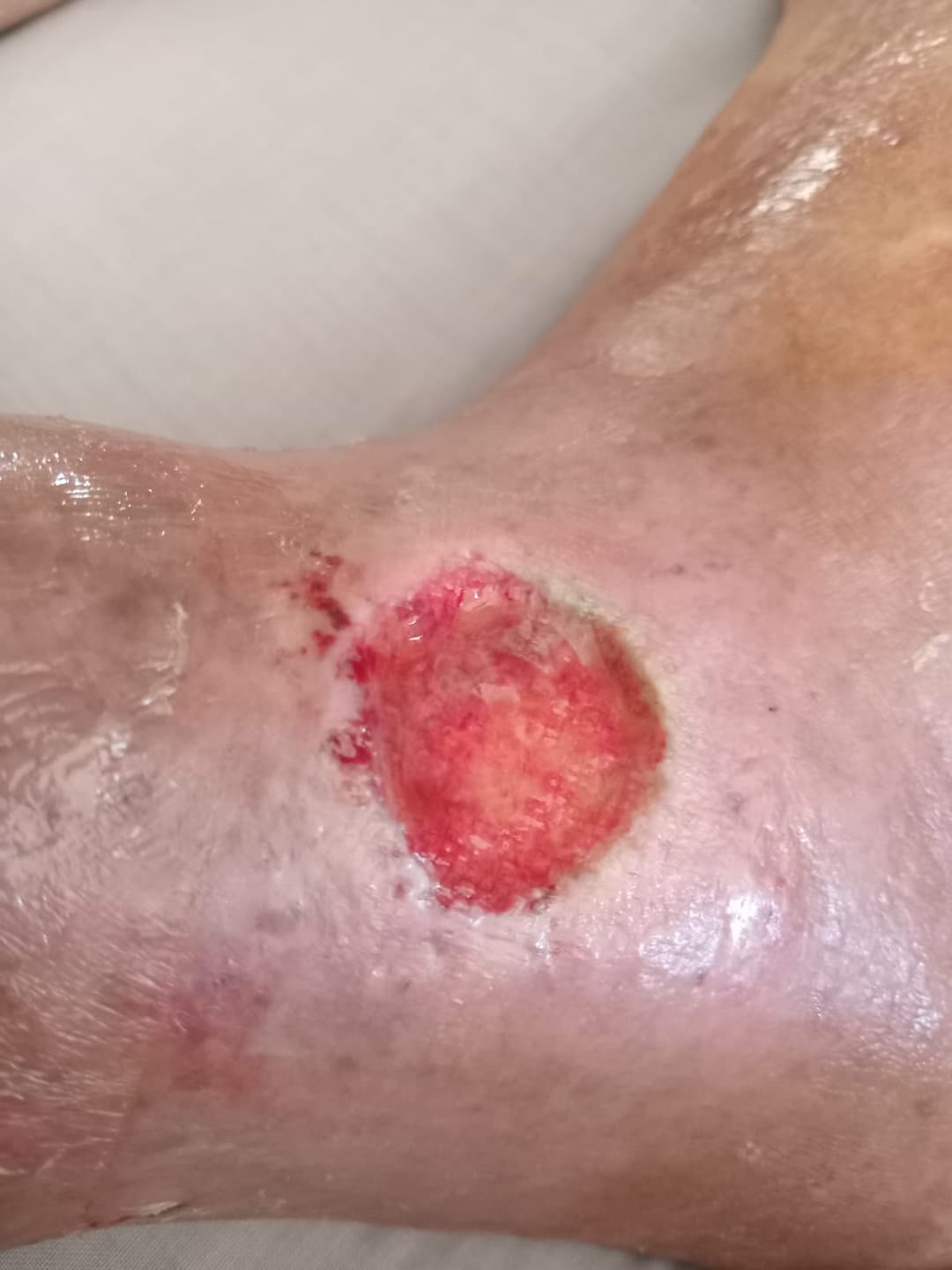 Before Treatment 2