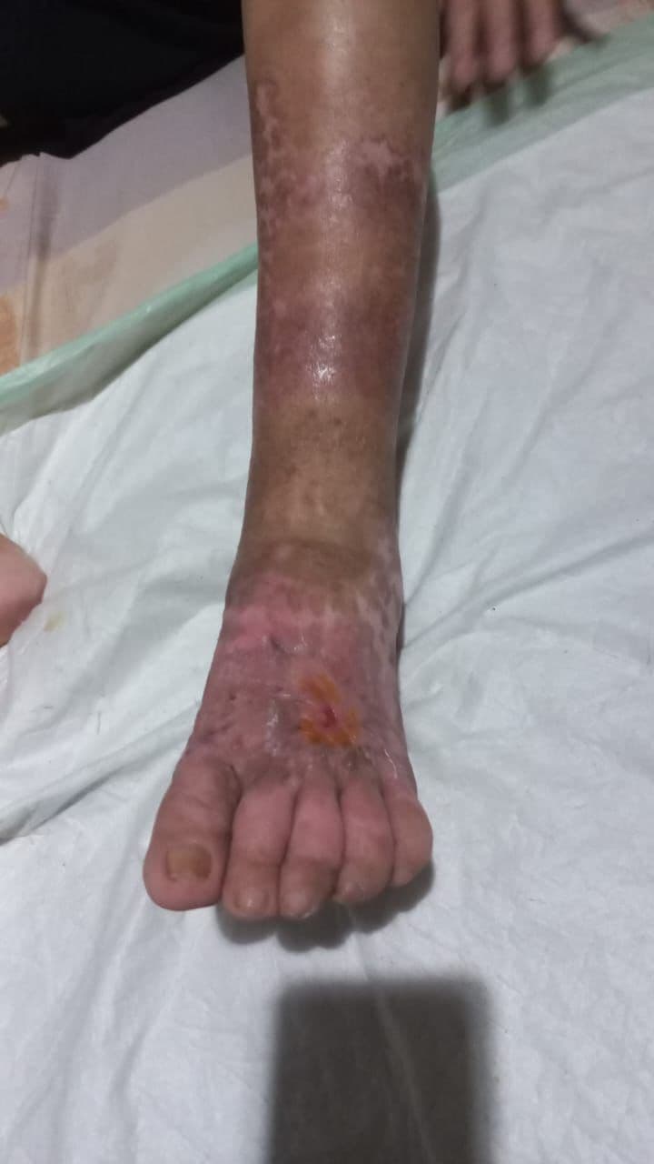After Treatment 3