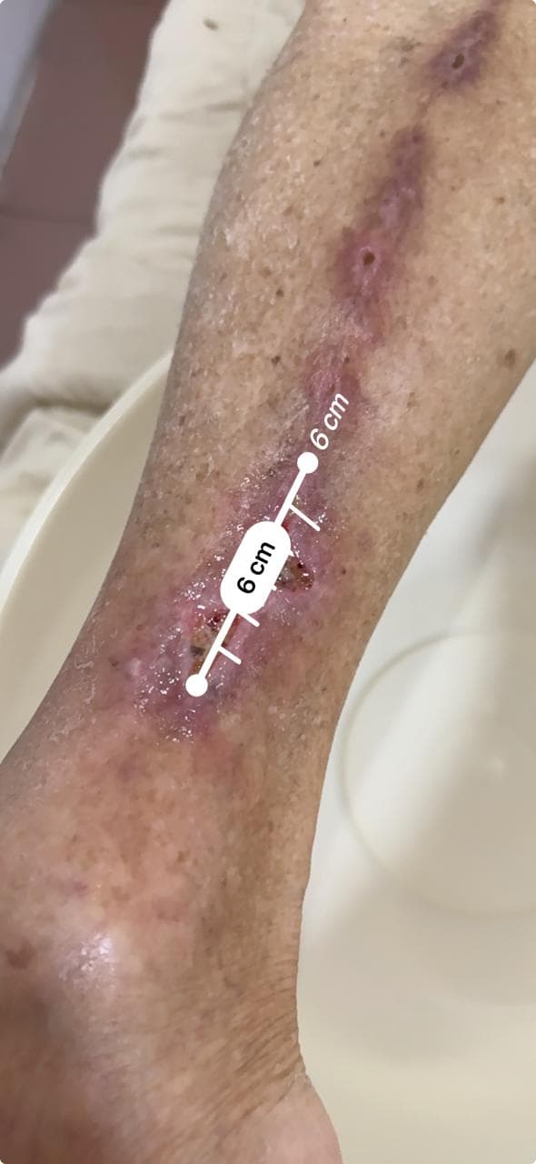 Before Treatment 1